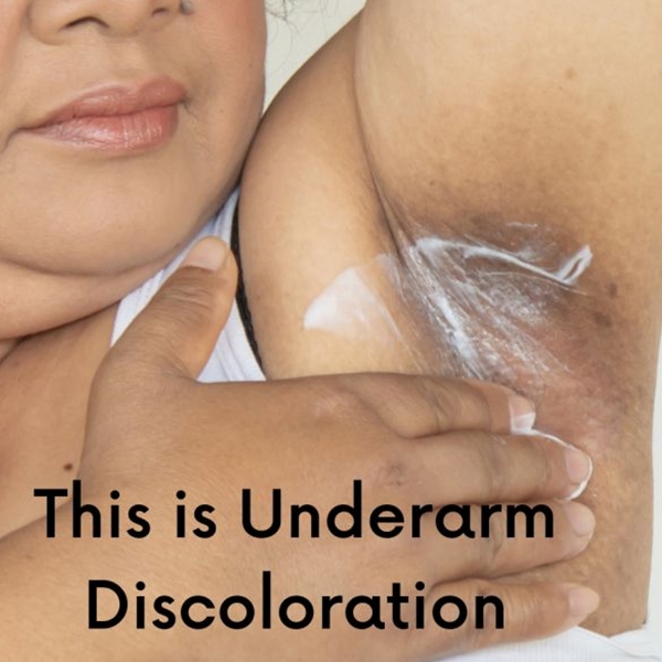 DERMADoctor_Total_Nonscents_ultra_gentle_Brightening_Antiperspirant_Discoloration.jpg blank