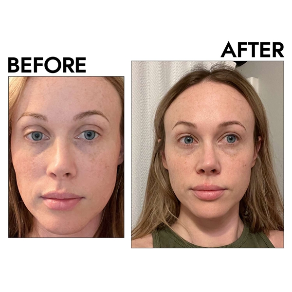 The_Inkey_List_Niacinamide_usage blank